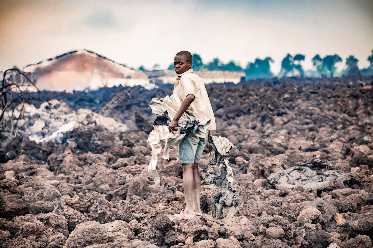 A child in damage from the volcano